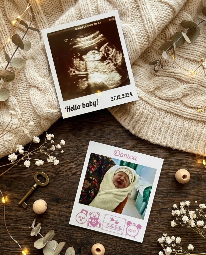 Ultrazvuk bebe & Moj prvi magnet - 8,7 x 10 cm ✨📷 🧲
